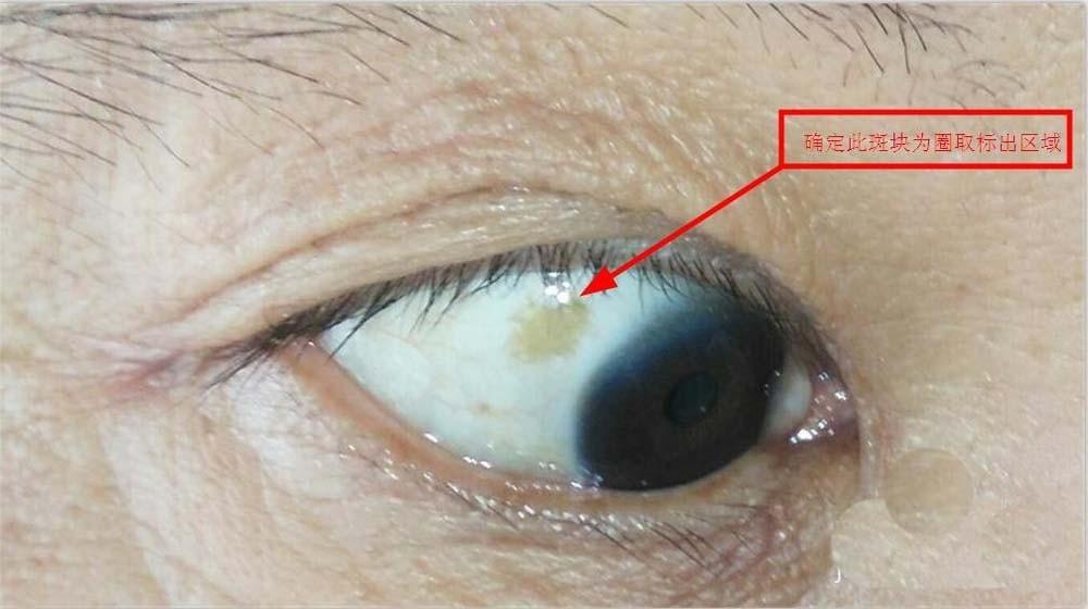 2345看图王怎么给图片添加圆圈?