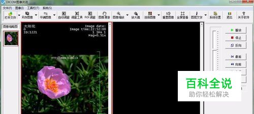 dcm文件怎么打开