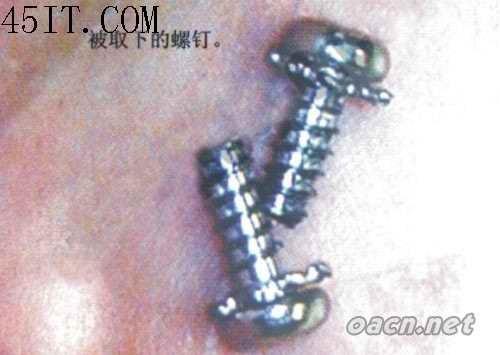 惠普C436A鼓粉盒加粉方法(图解)