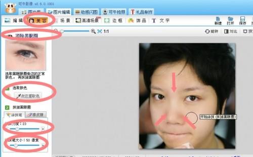 可牛影像祛痘新办法:4步呈现如玉肌肤