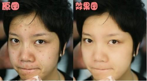 可牛影像祛痘新办法:4步呈现如玉肌肤