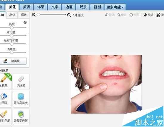 美图秀秀怎么快速去除照片中的痘痘和斑祛?