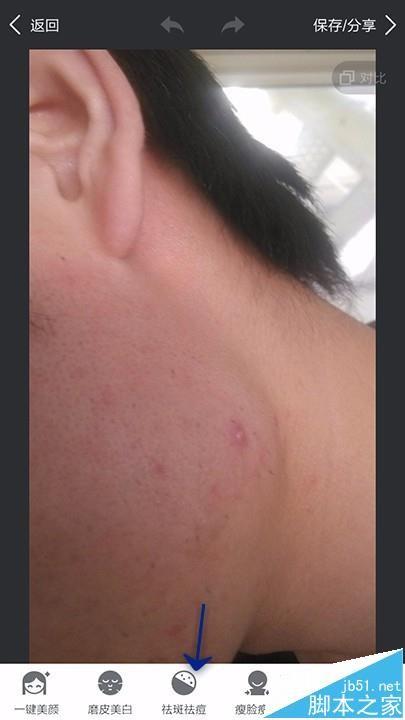 美图秀秀app怎么给照片祛斑祛痘?