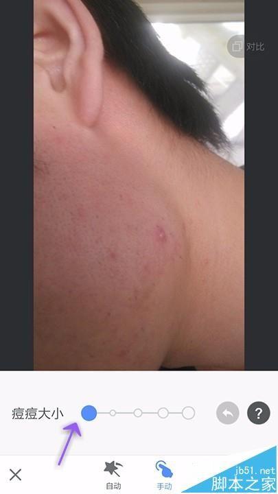 美图秀秀app怎么给照片祛斑祛痘?