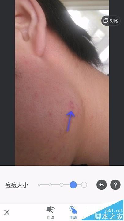 美图秀秀app怎么给照片祛斑祛痘?