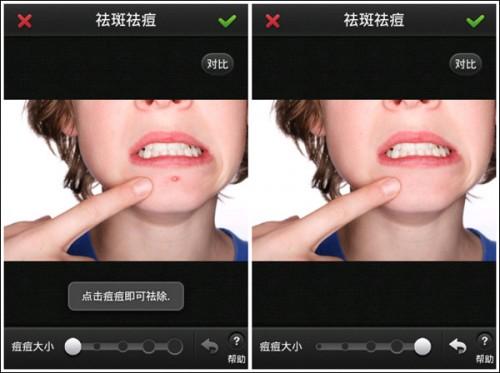 美图秀秀手机版让你告别脸部瑕疵 一秒变大美人