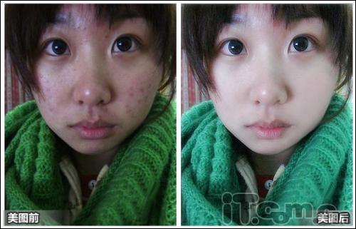 美图秀秀一分钟除痘法 无痘素颜也美丽