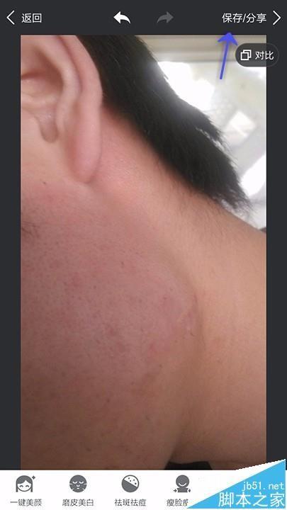 美图秀秀app怎么给照片祛斑祛痘?