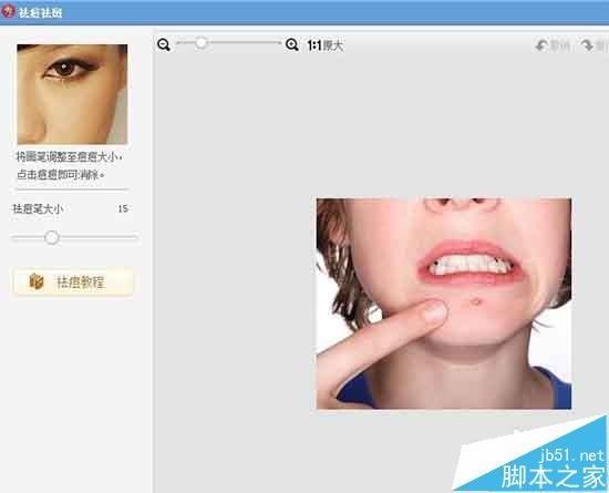 美图秀秀怎么快速去除照片中的痘痘和斑祛?