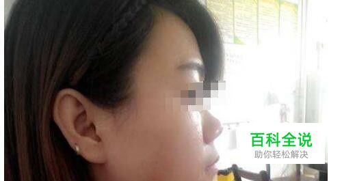 photoshop中如何去掉脸上的斑点？