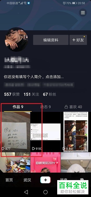 如何取消抖音APP中的视频置顶