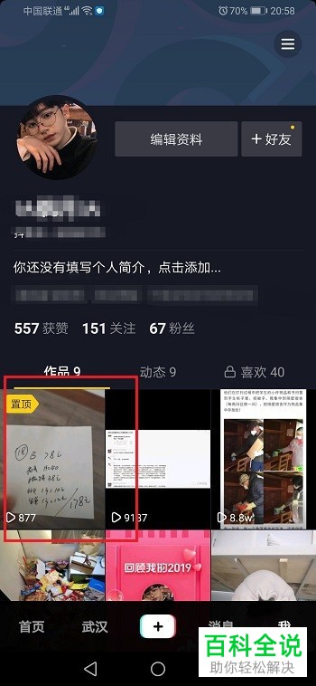 如何取消抖音APP中的视频置顶