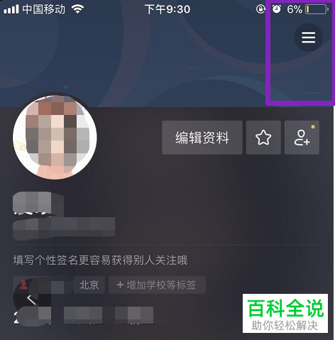 怎么关闭抖音的“抖一抖”打开随拍相机功能？