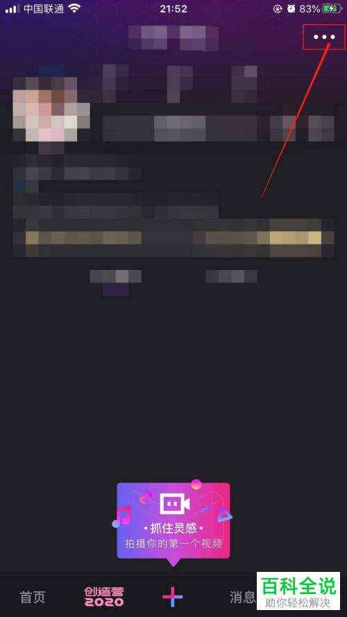 怎么将自己的微视账号注销